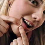Η σοκολάτα δεν σχετίζεται με εμφάνιση ακμής στους εφήβους