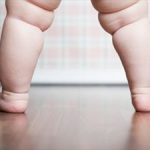 Τα παιδιά που γεννιούνται με καισαρική έχουν μεγαλύτερες πιθανότητες να εμφανίσουν υψηλό βάρος