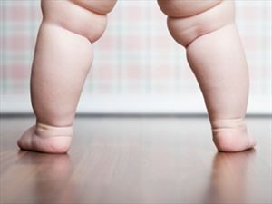 Τα παιδιά που γεννιούνται με καισαρική έχουν μεγαλύτερες πιθανότητες να εμφανίσουν υψηλό βάρος