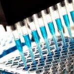 Οι ειδικοί χτυπούν καμπανάκι για τη φυματίωση