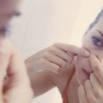 Να, γιατί δεν πρέπει να πειράζουμε τα σπυράκια!