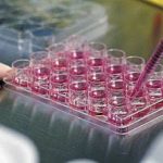 Βλαστοκύτταρα από ομφαλοπλακουντιακό αίμα: γιατί πρέπει να φυλάσονται