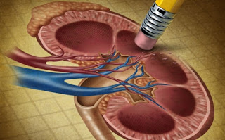 Η νεφρική νόσος στα παιδιά προλαμβάνεται