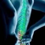 Νεότερα δεδομένα για την αγκυλοποιητική σπονδυλίτιδα