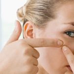 Τρεις μόνο κινήσεις αρκούν για να απαλλαγείτε από την ακμή!