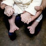Παγκόσμιο ενδιαφέρον για το αγοράκι στην Κίνα που γεννήθηκε με 31 δάχτυλα
