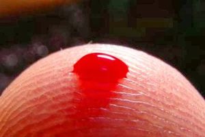 Επτά πανέξυπνοι τρόποι για να σταματήσετε την αιμορραγία!