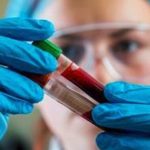 Νέα μελέτη συσχετίζει την παχυσαρκία με τη γήρανση του εγκεφάλου