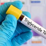 Τι πρέπει να τρώτε για να μειώσετε τα τριγλυκερίδια